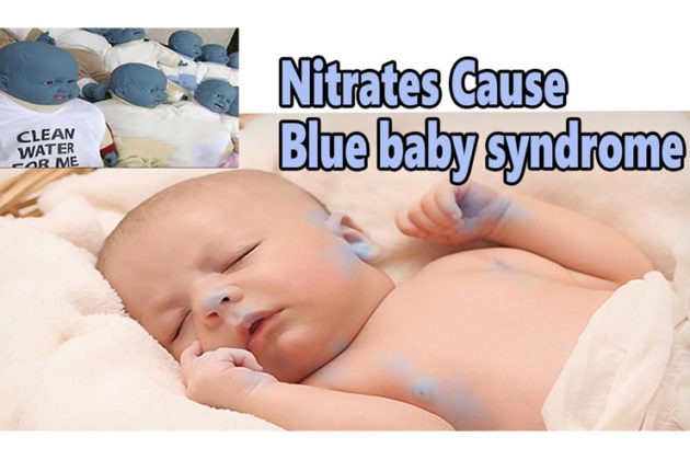 blue-baby-syndrome-causes-treatment-and-prevention